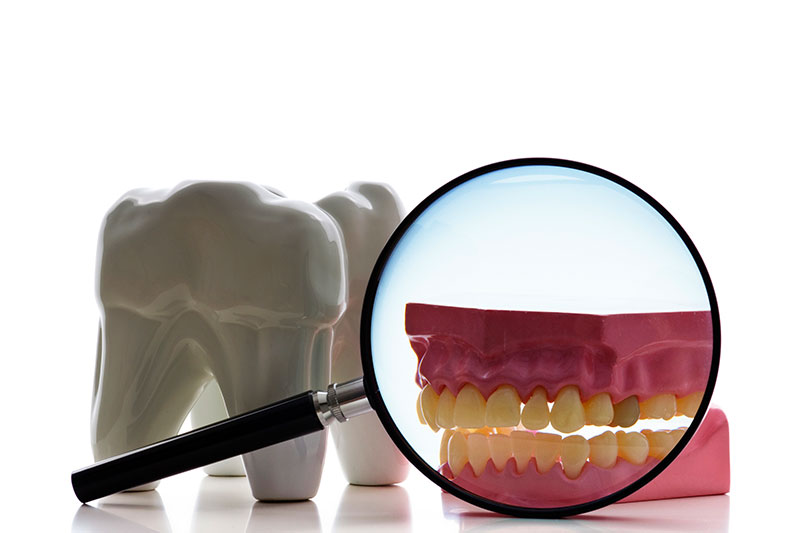Root Canal Treatment in Kokomo