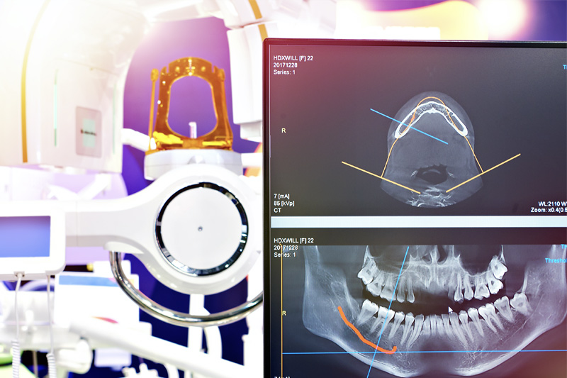 Digital X-Rays and Cone Beam CT Imaging in 